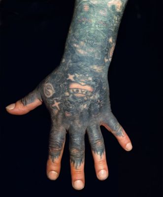 Kalervo (hand) 5 000 € / Marked skin, 1999-2000, 110 x 86 cm, c-print black wooden frames + glass, signed, ed. 1/10