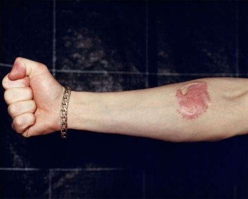 Teemu (hand) 2 500 € / Marked skin, 1999-2000, 52 x 56 cm, c-print black wooden frames + glass, signed, ed. 1/10